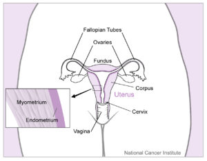 uterus-endometriose-etiopathe-osteopathe-bordeau-langon utérus-endometriose